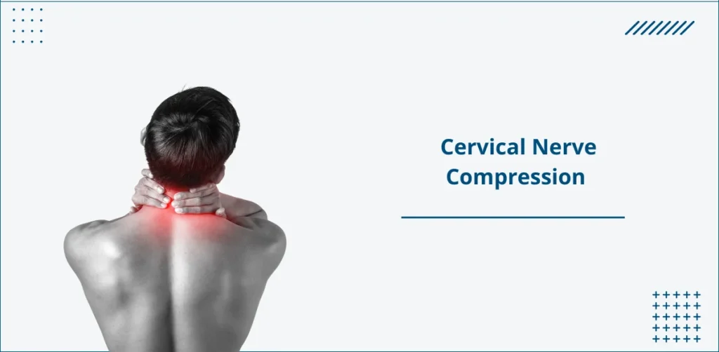 Cervical Nerve Compression ​